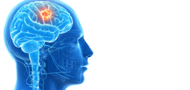 Brain Surgery